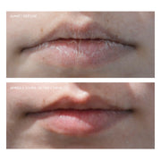 Repairing lip balm